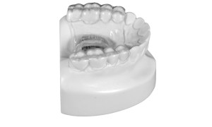 Removable Leaf Expander