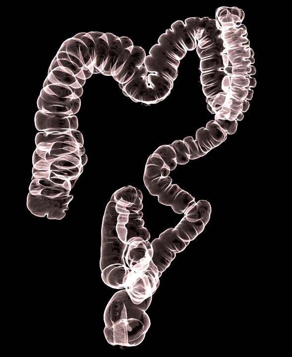 CP Advanced Imaging CT Virtual Colonoscopy