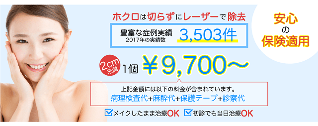 ほくろ除去が神戸で安いおすすめ人気7選【取り放題&3000円キャンペーン&保険適用】