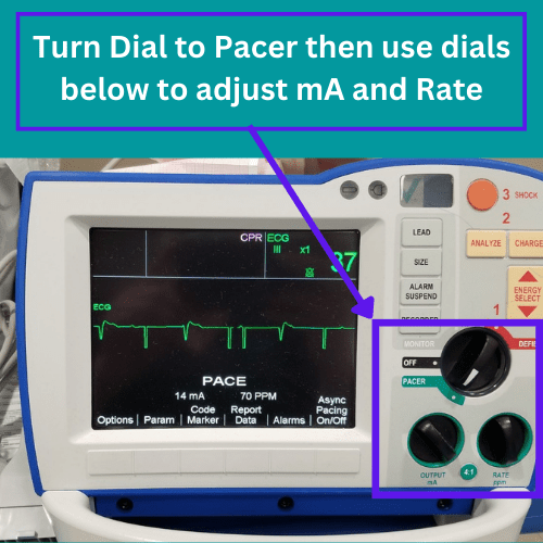 Transcutaneous Pacing (TCP) CPR Done Right CPR, ACLS, BLS Classes