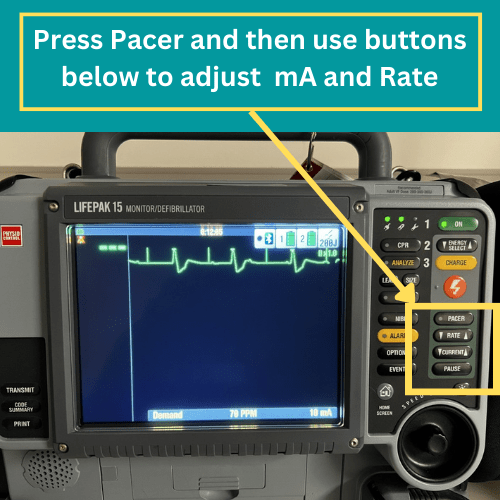 Transcutaneous Pacing (TCP) CPR Done Right CPR, ACLS, BLS Classes