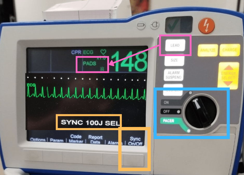 Synchronized Cardioversion CPR Done Right CPR, ACLS, BLS, PALS, NRP