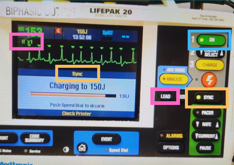 Synchronized Cardioversion CPR Done Right CPR, ACLS, BLS, PALS, NRP