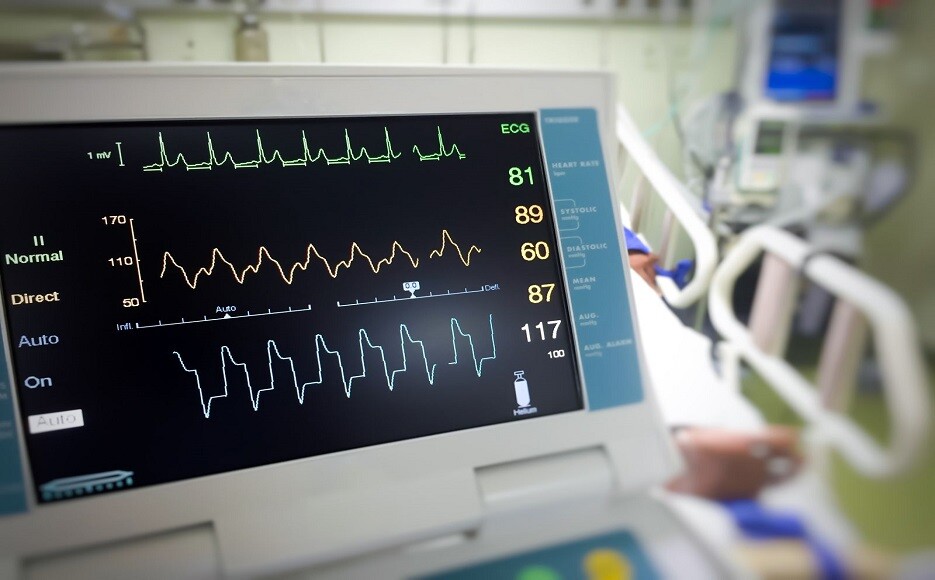 Common heart test cover removed from Medicare CPSA