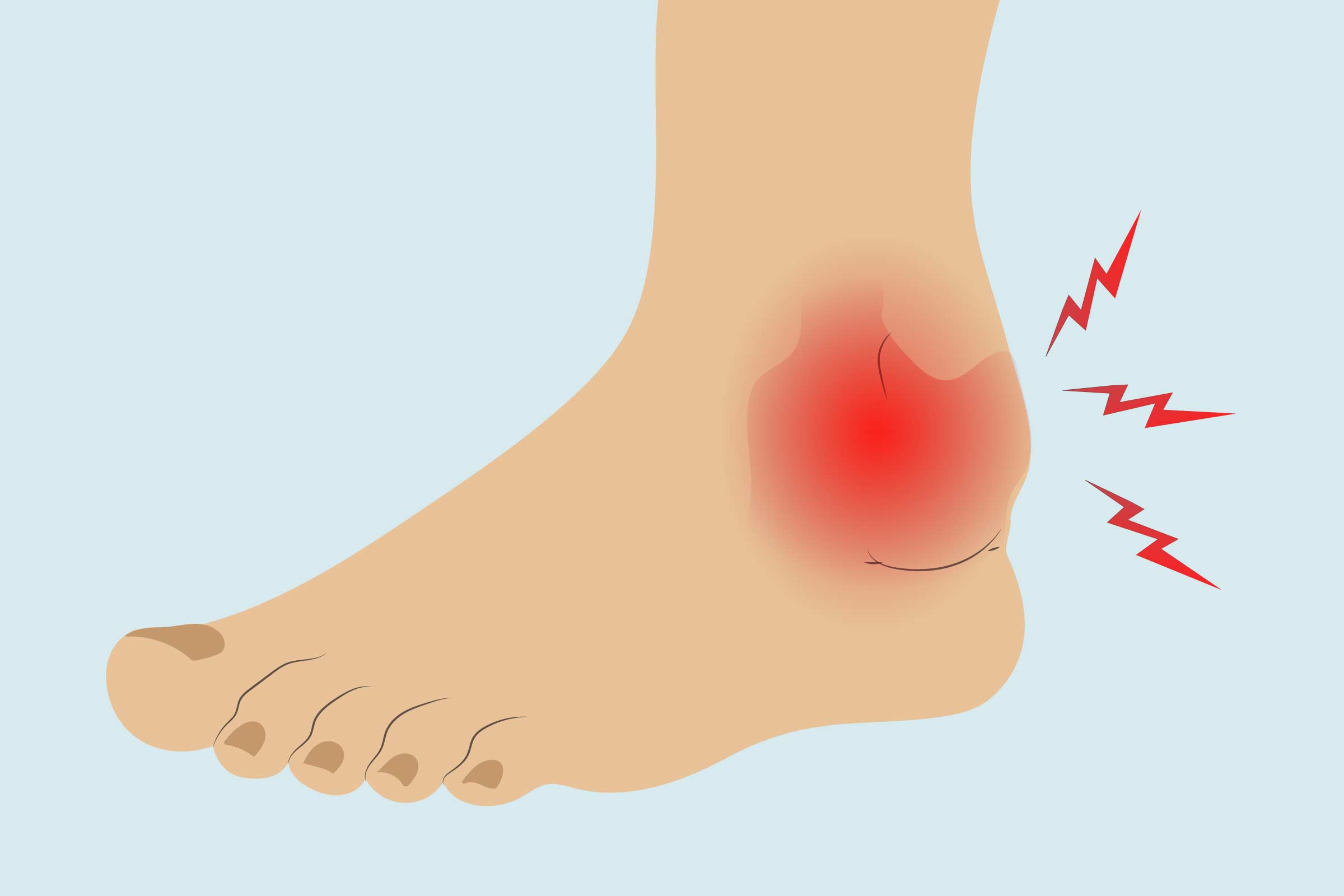 Arthritis In The Ankle: Treatments, Exercises, And Home Remedies