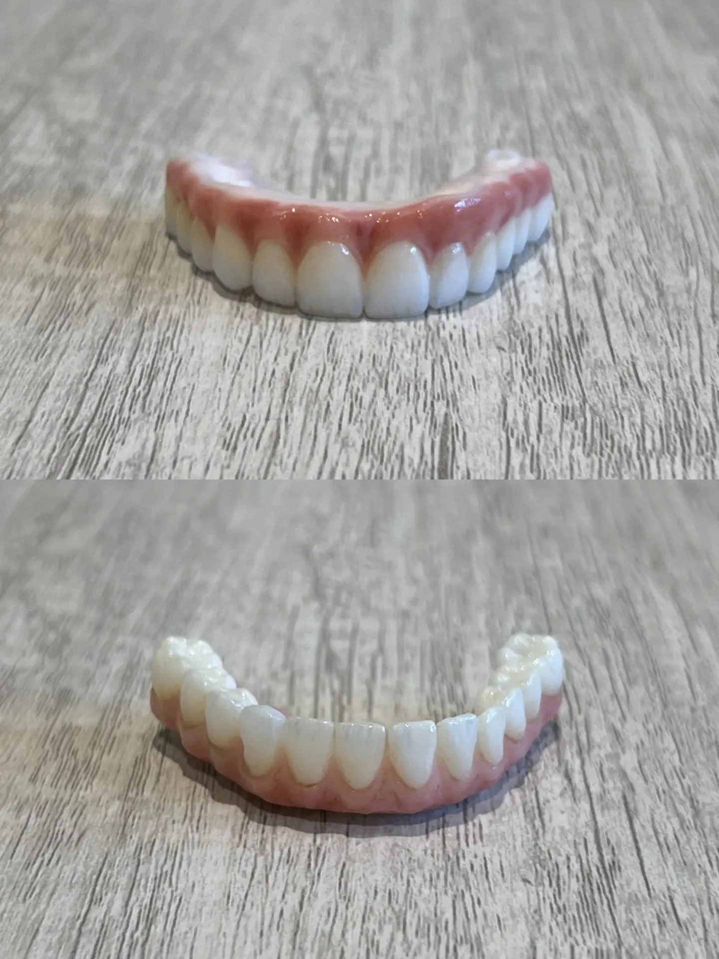 AllOn4 Dental Implants Villanova Dental Group & Implant Center