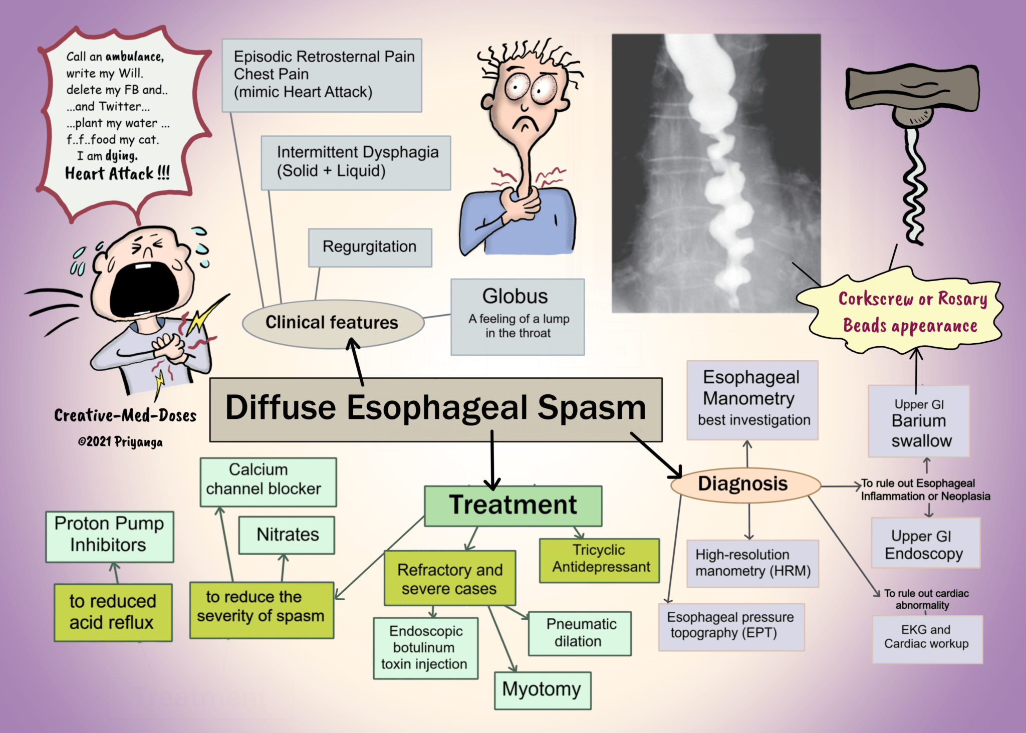 Esophageal Spasm