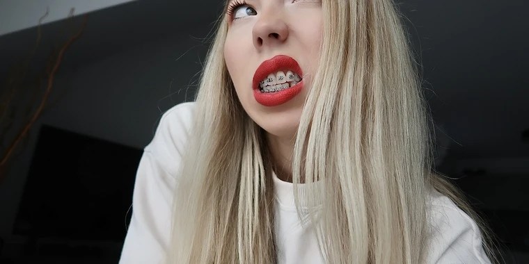 Kate in Braces OnlyFans | @kateinbraces review (Leaks, Videos, Nudes)
