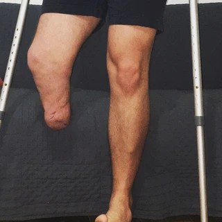 AMP_lified OnlyFans | @amputeex review (Leaks, Videos, Nudes)