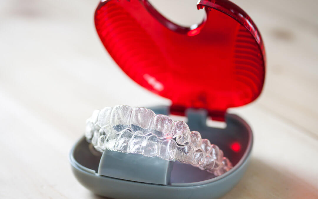 How to Get Invisalign A StepbyStep Guide to Getting Started Today