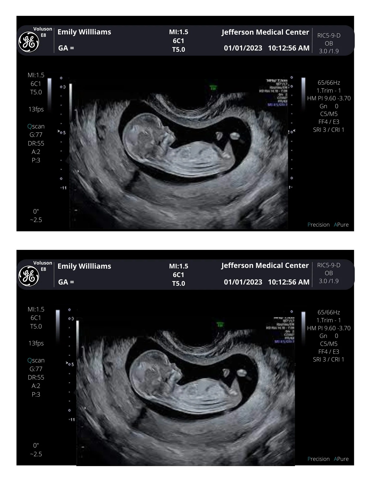 Fake Ultrasound Picture creetify