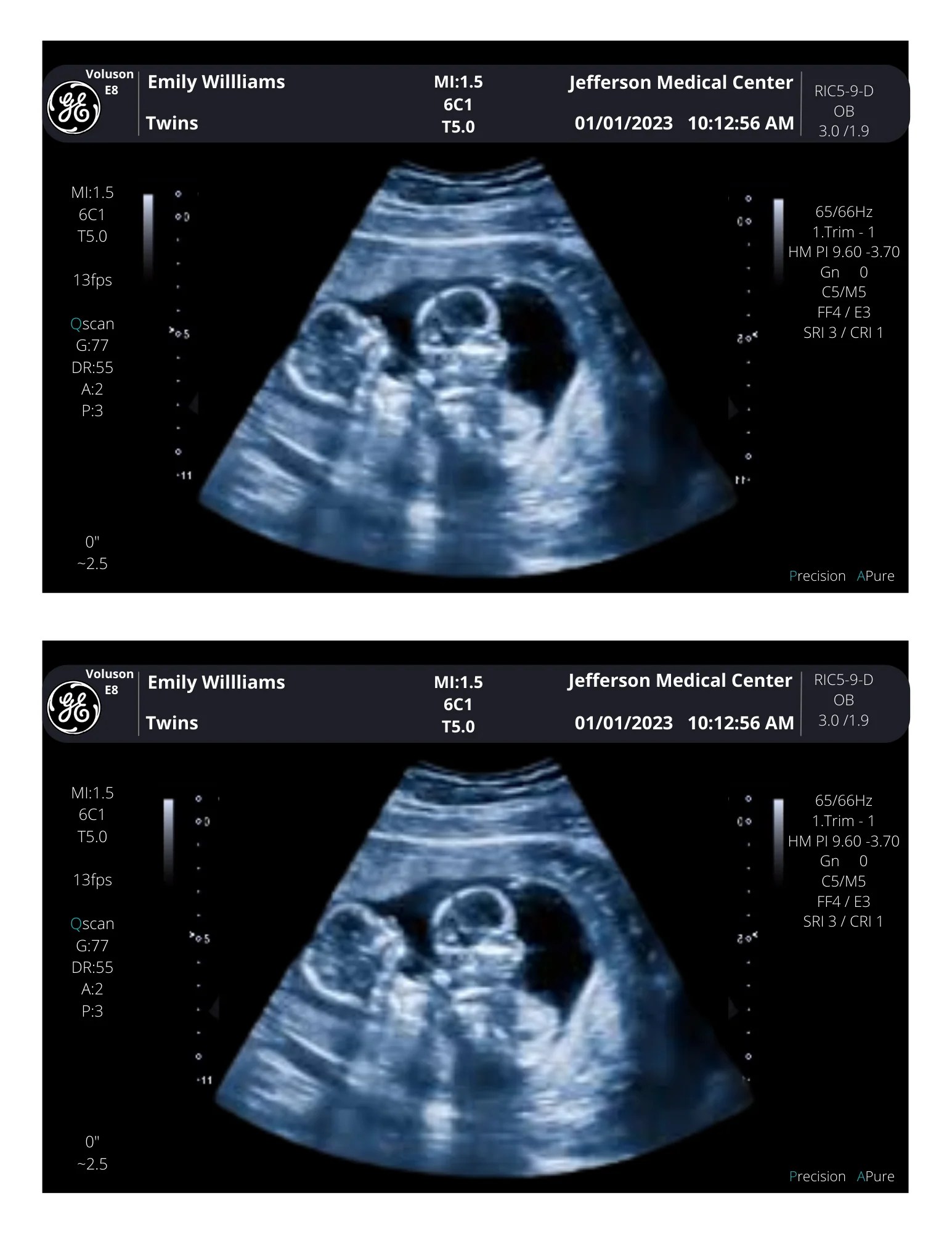 Twins Fake Sonogram Picture!! From 340 weeks! Customizable Digital