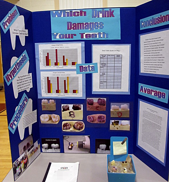 Tooth Decay Science Project Board imgprimrose