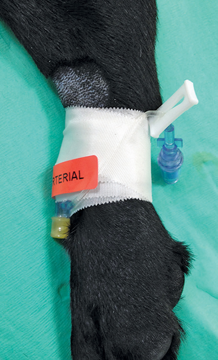 Blood Pressure Monitoring Vital Yet Under Appreciated