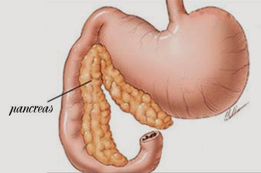 Acute Pancreatitis A Disease That Should Not Be Ignored!