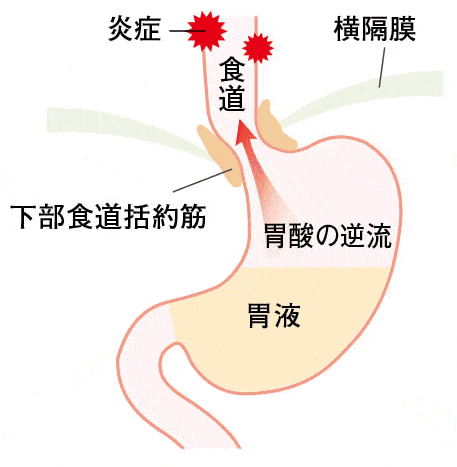 寝る前にたった10秒！胃腸を整える簡単リラックス法｜胃腸を最速で強くする｜奥田昌子 - 幻冬舎Plus Vol.34 食事をするといつも胸やけします。【40歳からのからだ塾Web版】 | 医療と健康 | ページ 2 | クロワッサン オンライン