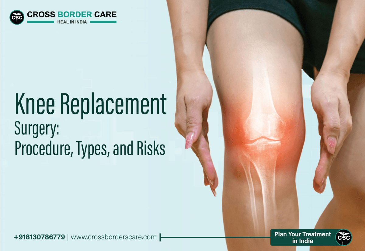 Knee Replacement Surgery Procedure, Types, and Risks