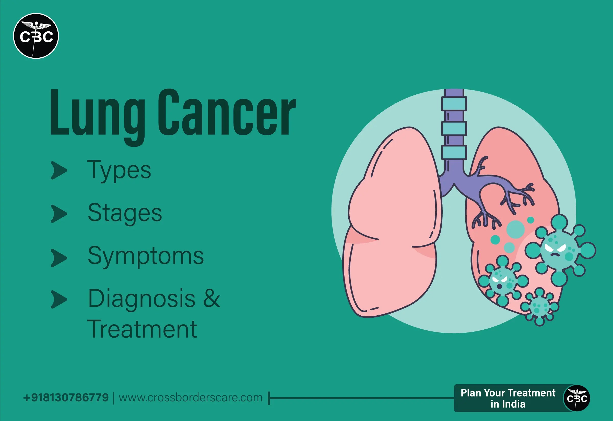 Lung Cancer Types, Symptoms, Diagnosis and Treatment