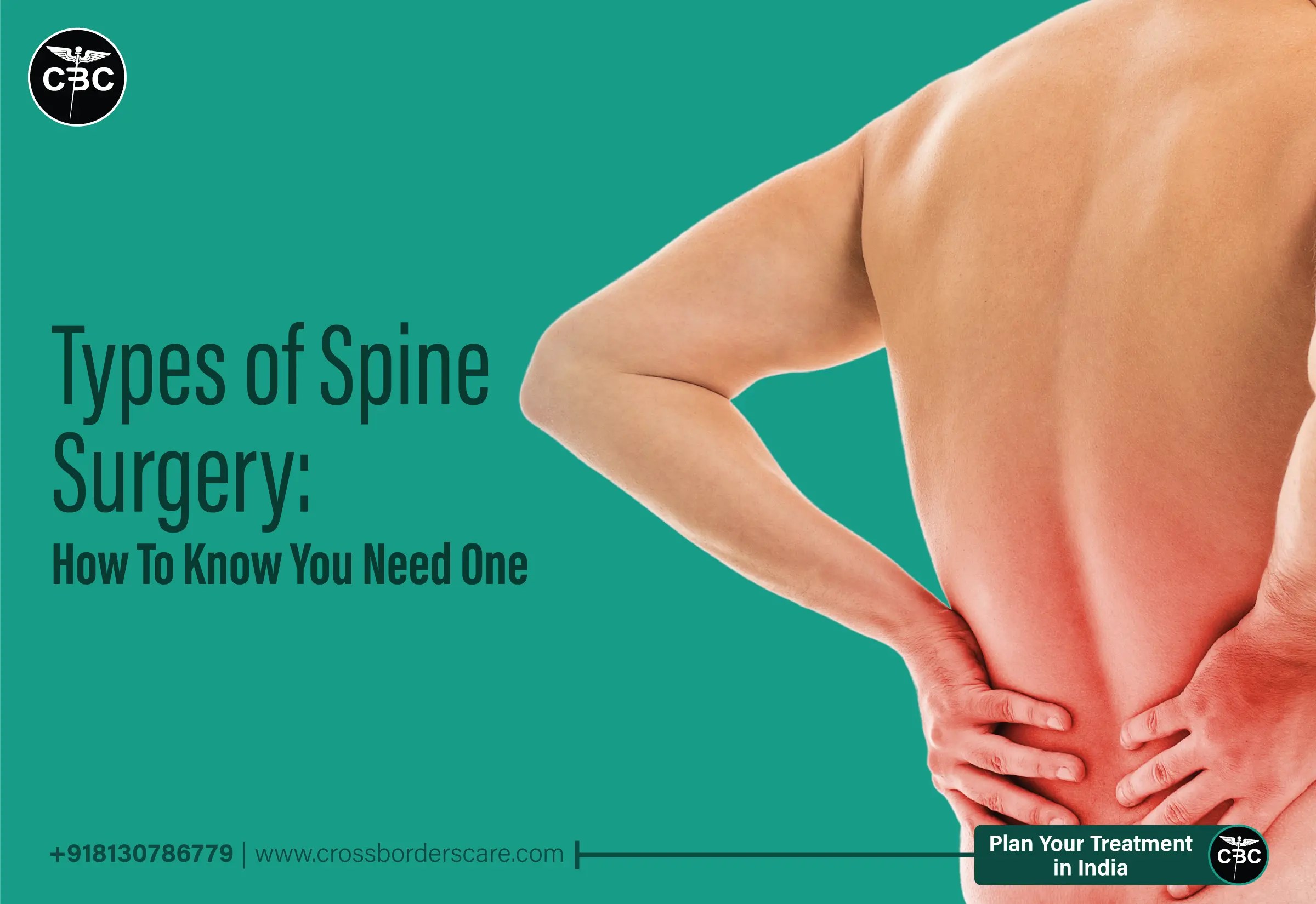 Types of Spine Surgery How to Know You Need One
