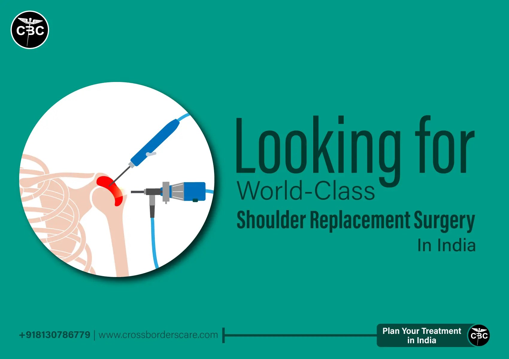 Shoulder Replacement Surgery and Its Cost in India