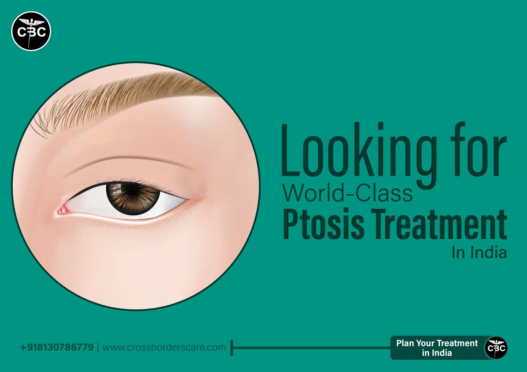 Ptosis Surgery Crossborders Care