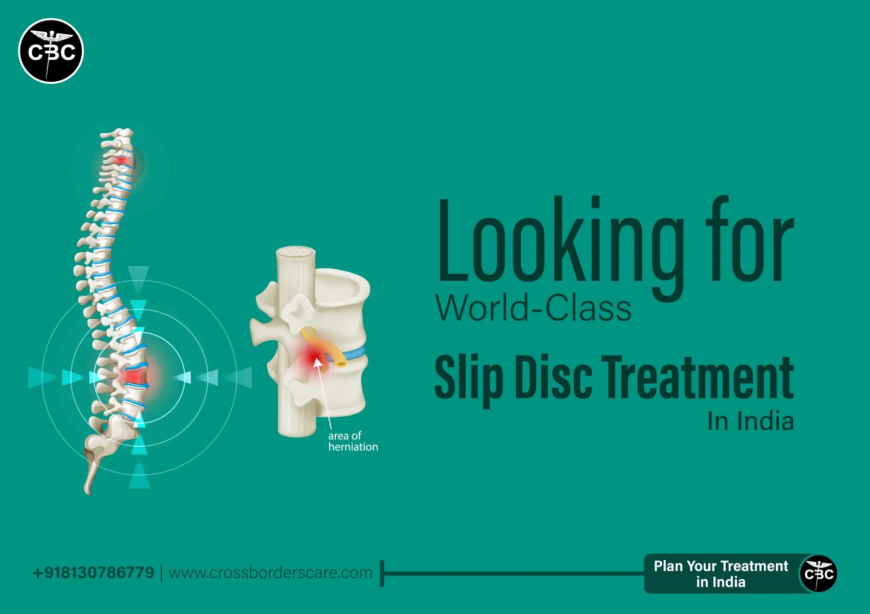 Spinal Surgery Cost in India