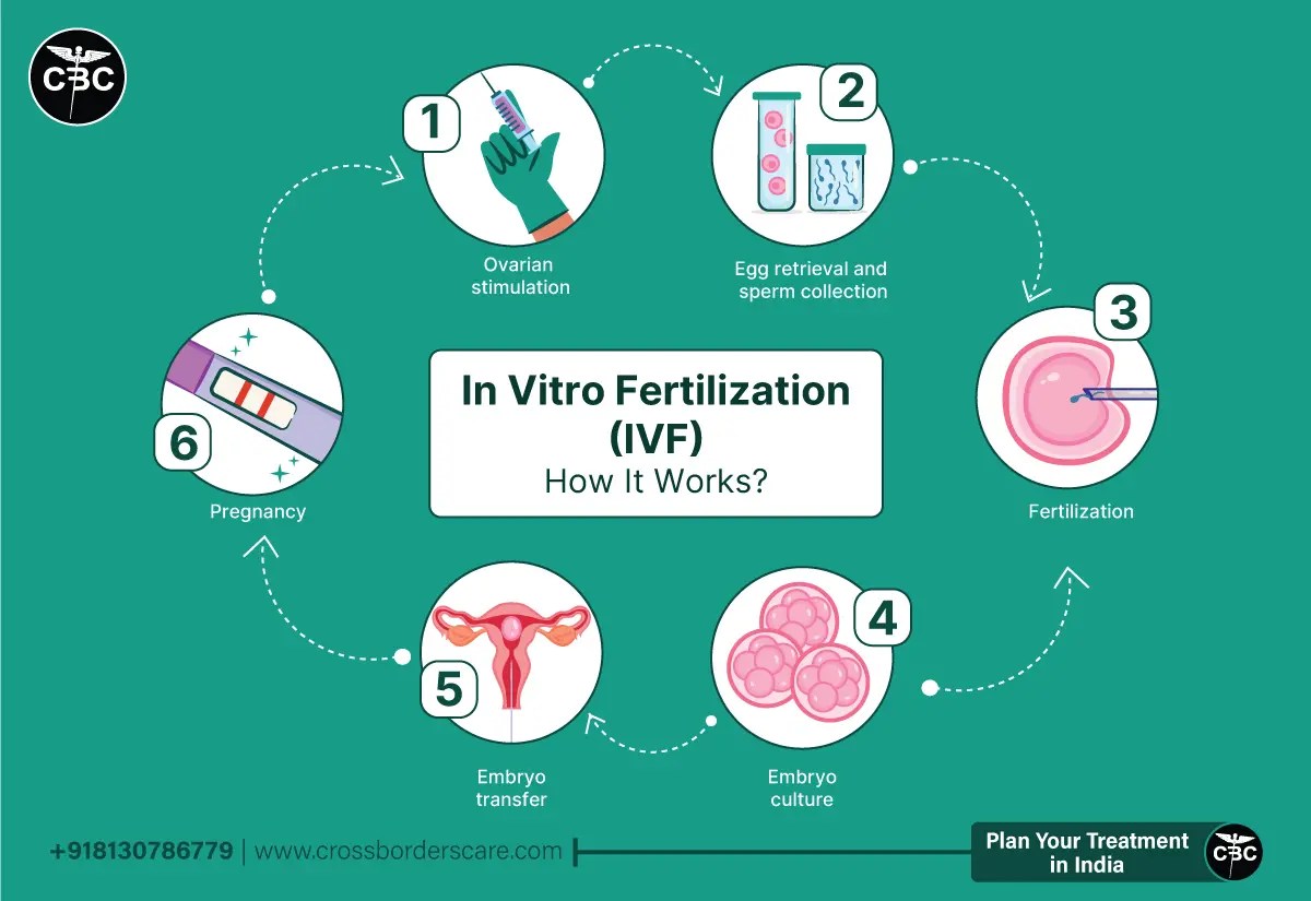 IVF (In Vitro Fertilization) Procedure & How It Works