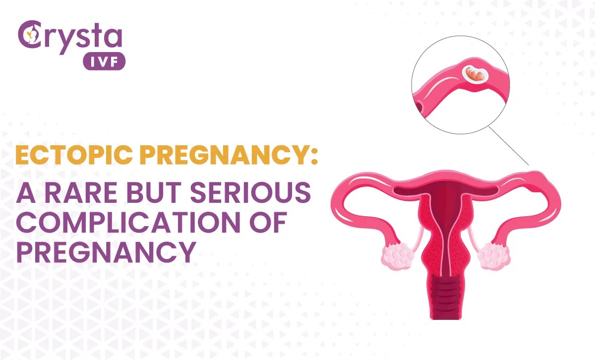 Ectopic Pregnancy Symptoms, Causes, & Treatment Options