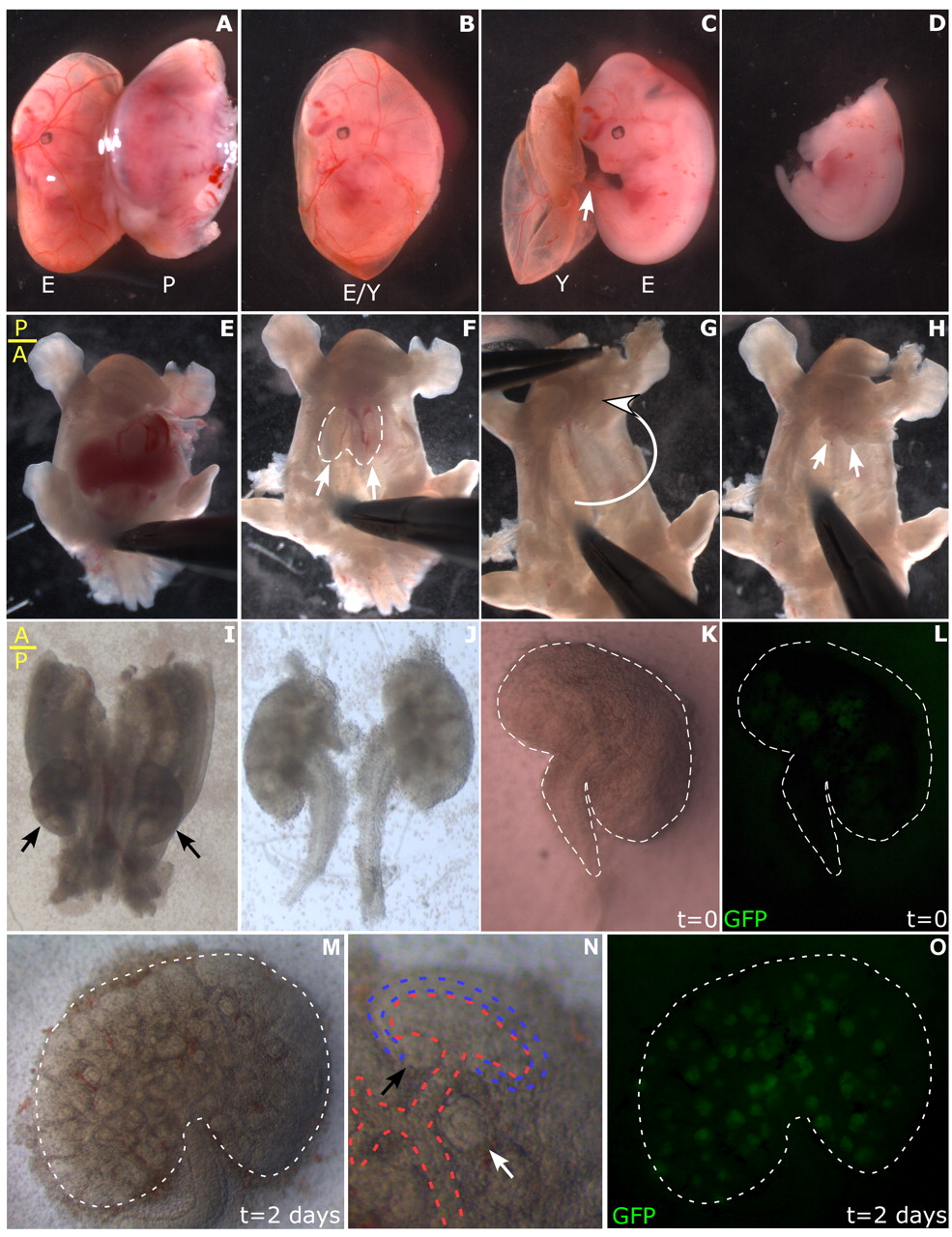 Organ Culture and Immunostaining of Mouse Embryonic Kidneys