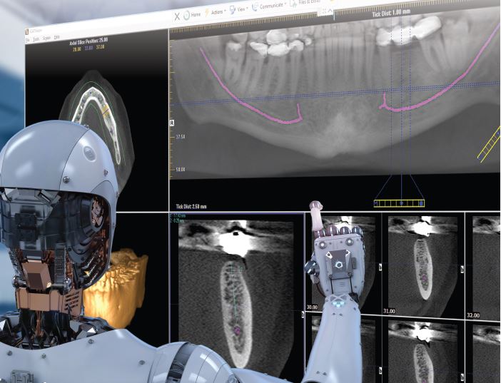 CT Dent AI software recently traced a perfect ID nerve in 4.5 seconds!