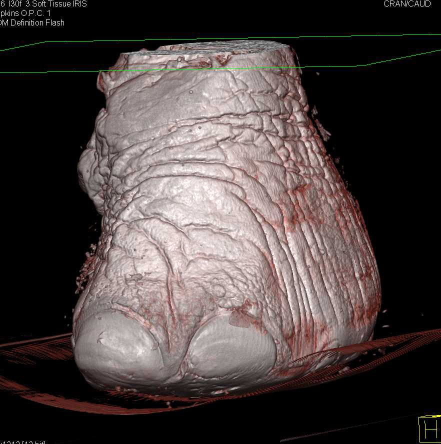 Elephant Foot in 3D Veterinary Case Studies CTisus CT Scanning