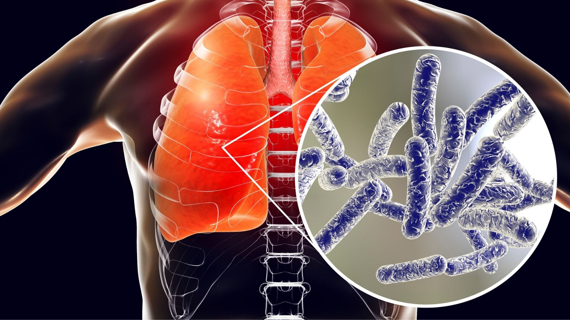 Tratamientos Legionella