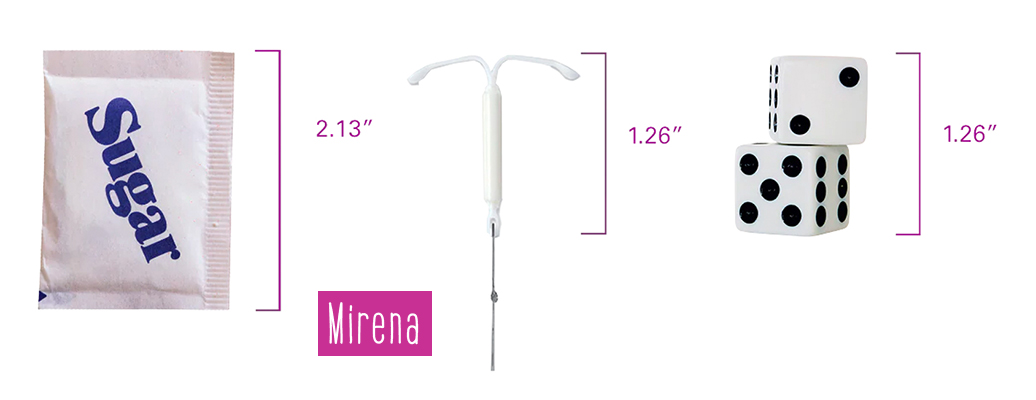 Types of IUDs | CU PAG