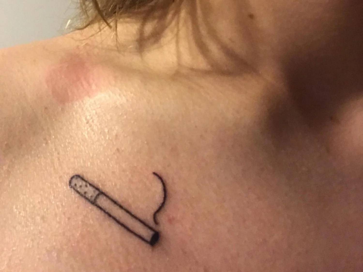 Best Excuses for Hickeys How To Get Out Of An Awkward Situation