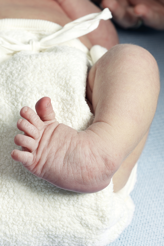 What is clubfoot? Curation of Knowledge