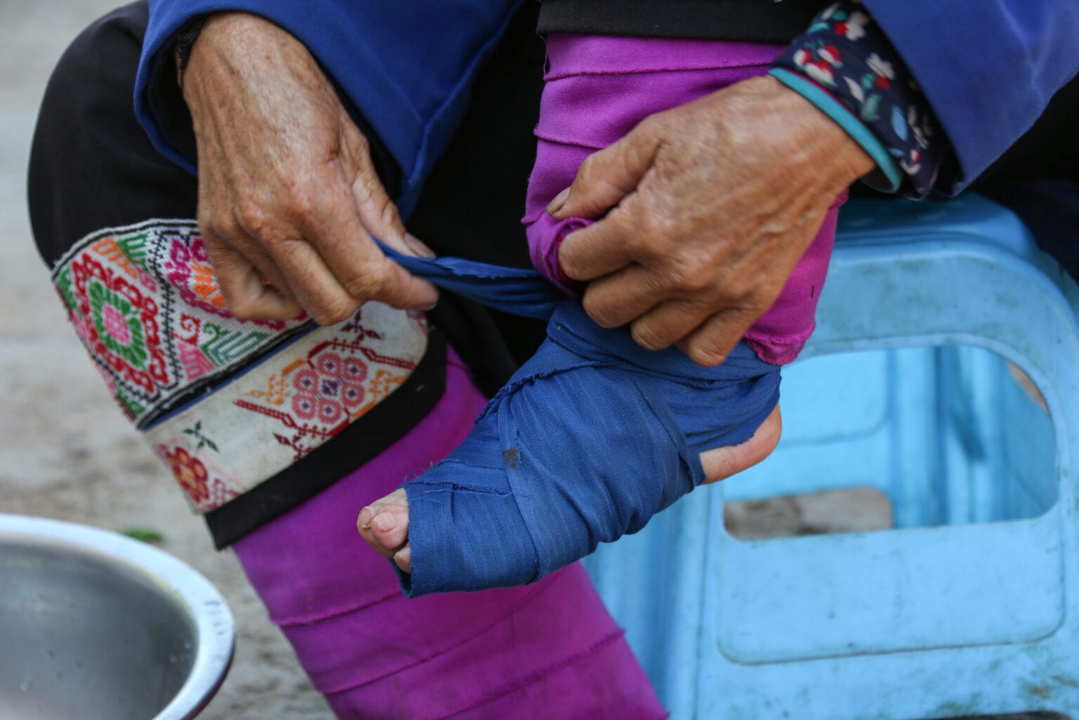 What was Chinese Foot Binding? Curation of Knowledge