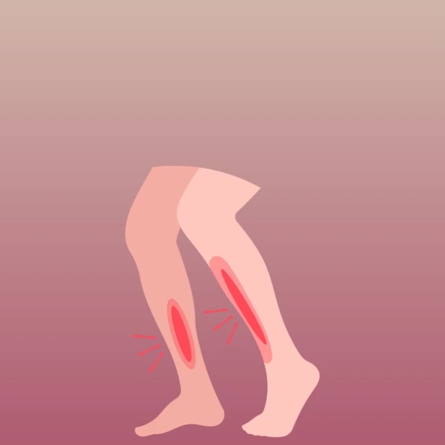 What are Shin Splints? Curavita