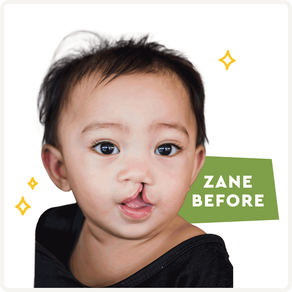 Smile Challenge CURE