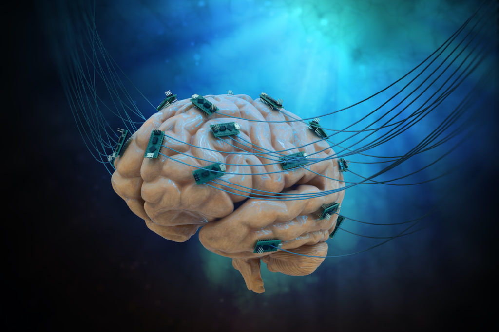 Connected brain Arthritis Research Arthritis National Research