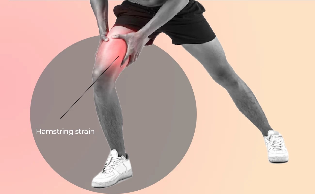 Hamstring strain » Curezone Physiotherapy