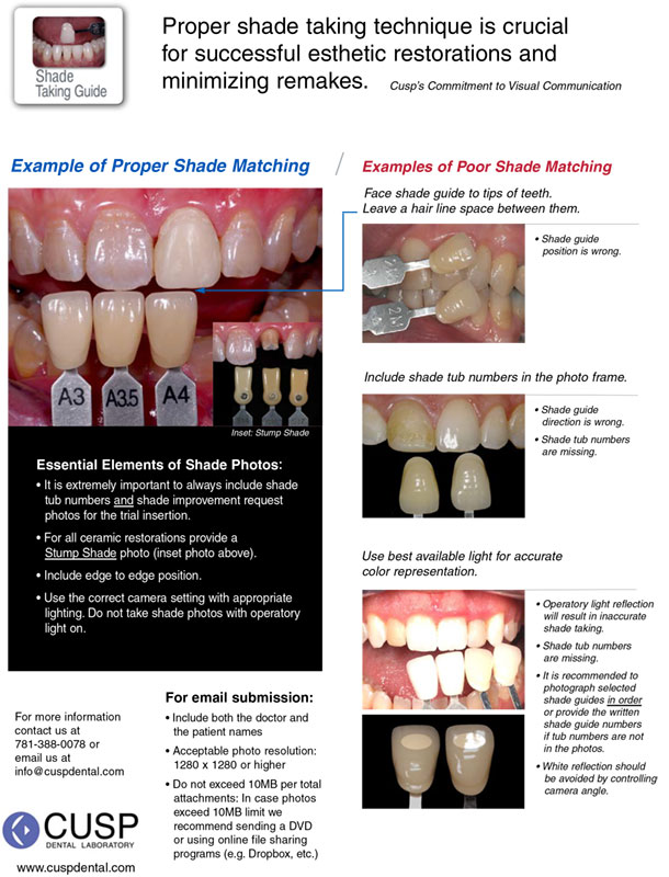 Shade Taking Guide CUSP