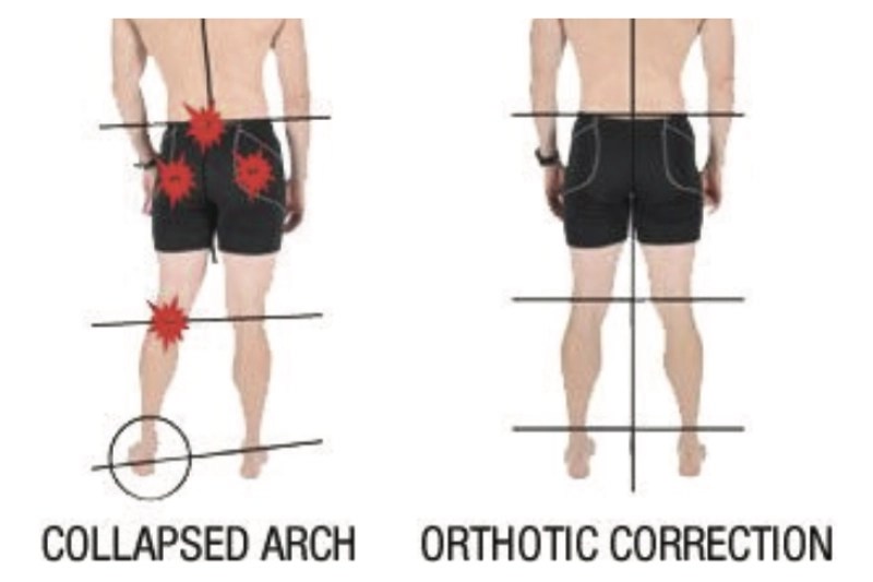 How Custom Orthotics Help Custom Orthotics Tucson