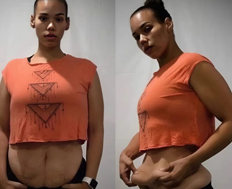 This Young Womans Dramatic Transformation Is Inspiring Thousands Of