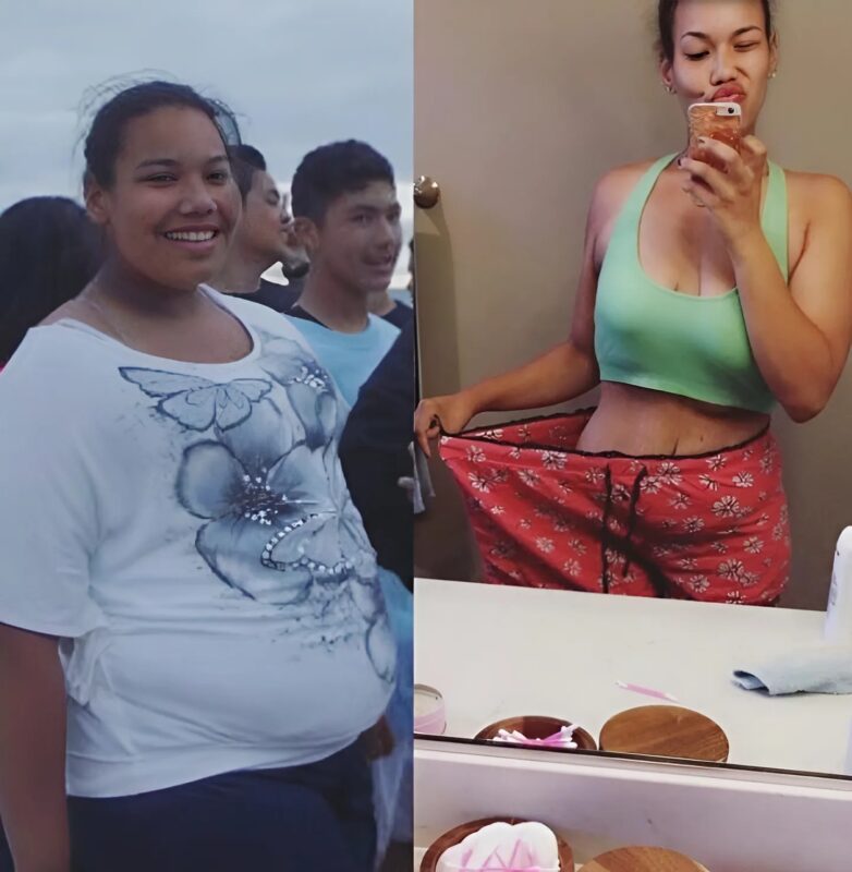 This Young Womans Dramatic Transformation Is Inspiring Thousands Of