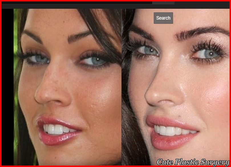 Megan Fox Plastic Surgery Pictures Revealed Celebrities Plastic Surgery(09)