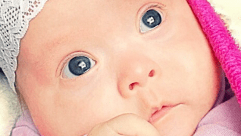 Baby With Down Syndrome Has The Prettiest Eyes Cutest Babies