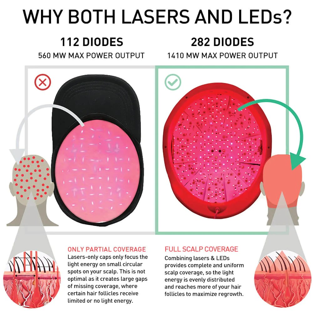 iRestore For Hair Loss Cutis Dermatology