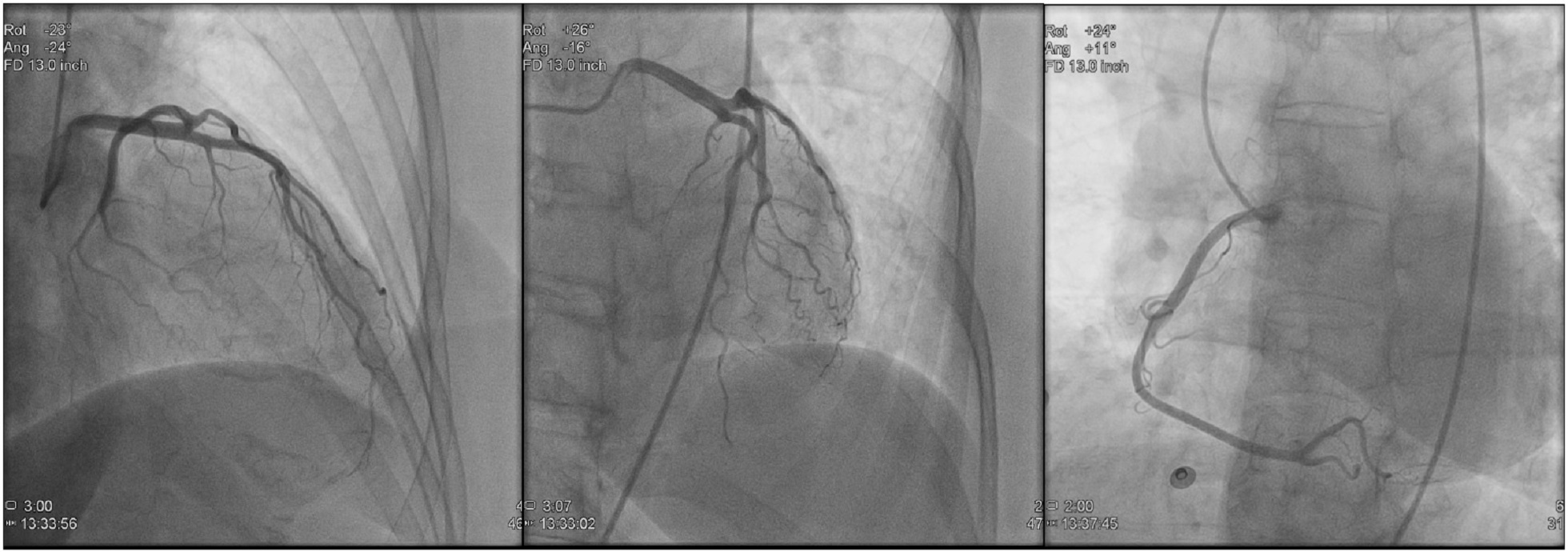 Cardiac Cath Lab Pocket Reference CVIR