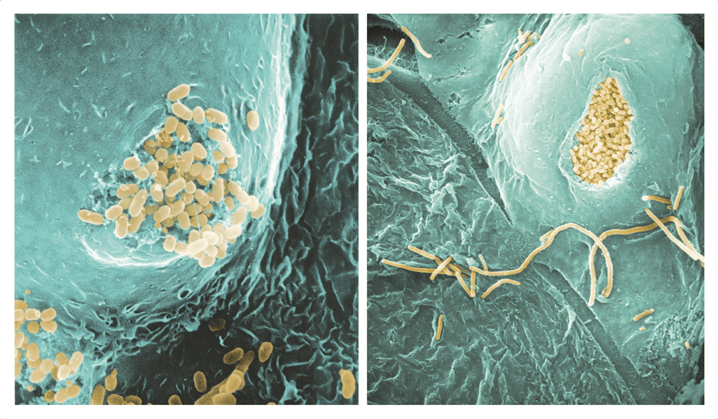 What Is Bacterial Urinary Tract Infection Ideas of Europedias