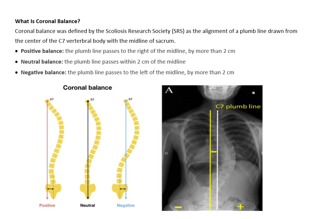 Plumb Line Scoliosis